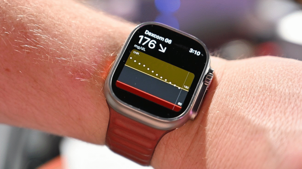 Apple Watch 13